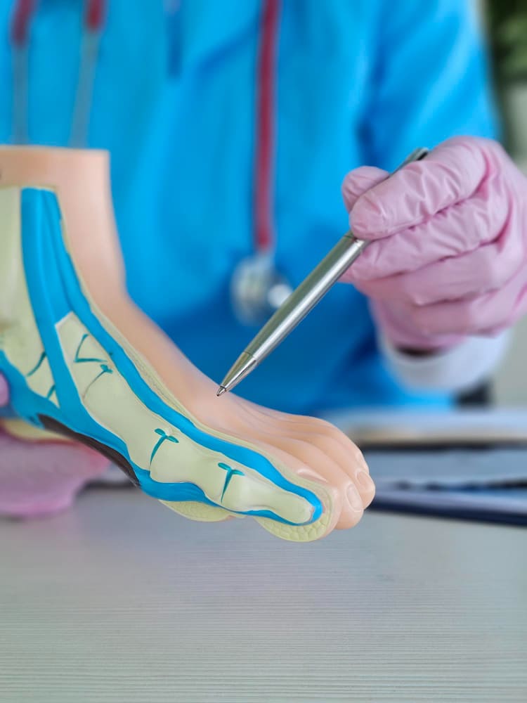 foto-destaque-ortopedista demonstra a anatomia do pé usando um modelo e uma caneta.
