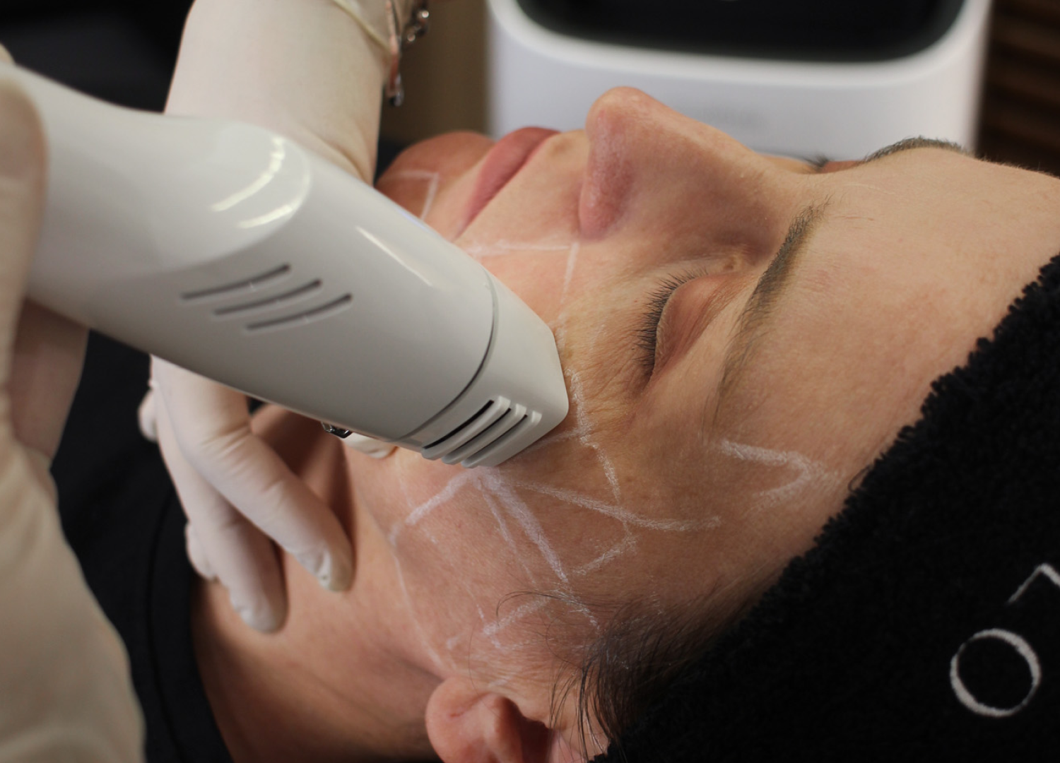 Clínica Dermatológica Reviva: Coolfase