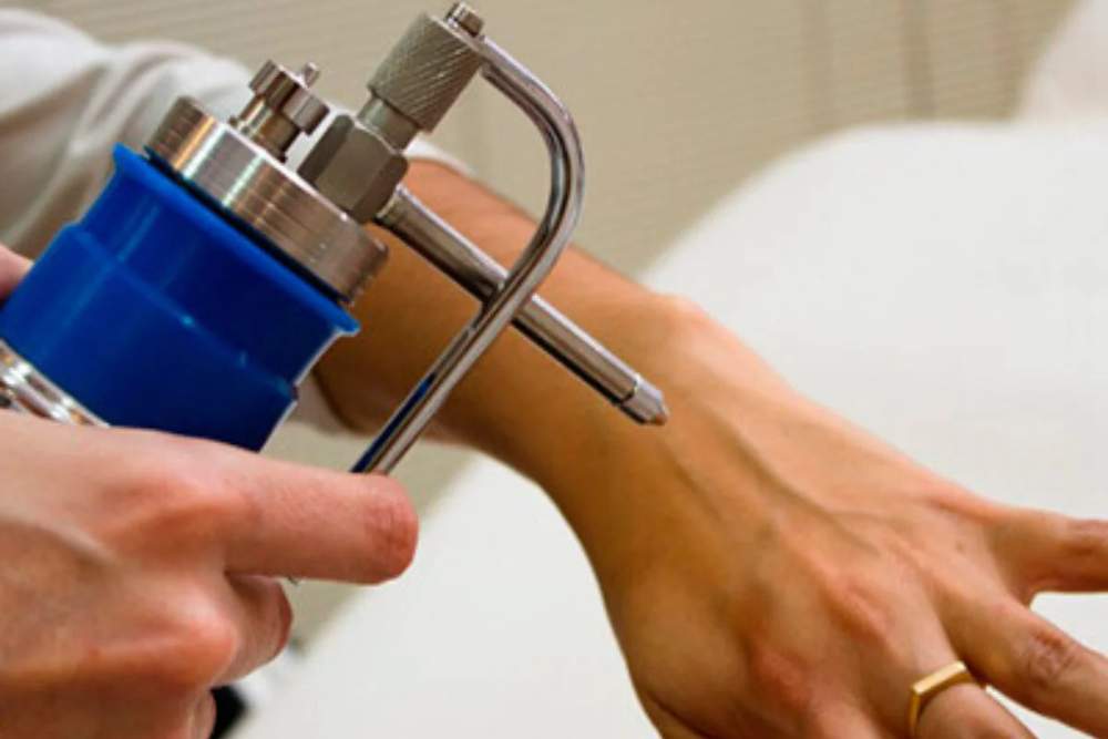 Clínica Dermatológica Reviva: crioterapia - remoção de verrugas e lesões de sol através do congelamento