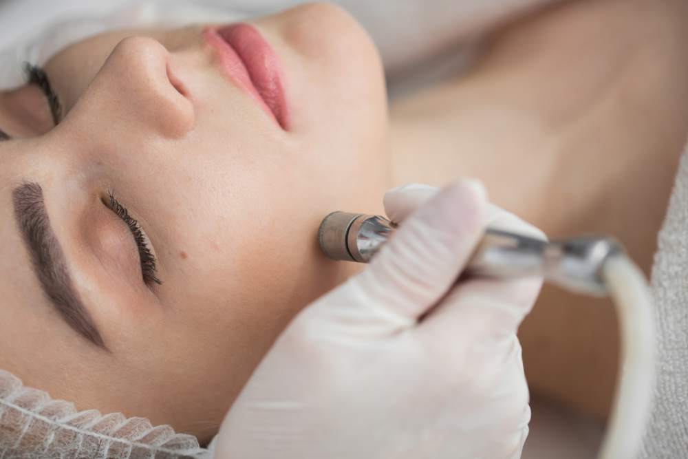 Clínica Dermatológica Reviva: Peeling