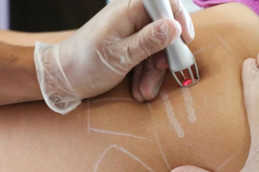 Clínica Dermatológica Reviva: Tratamentos a Laser